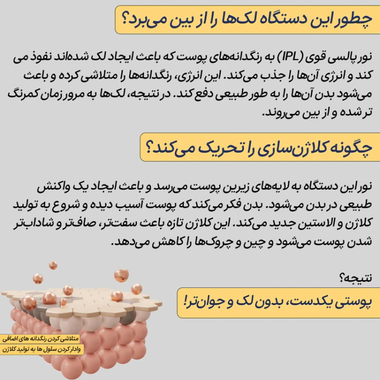 دستگاه لیزر صورت و بدن خانگی مدل TMY-002